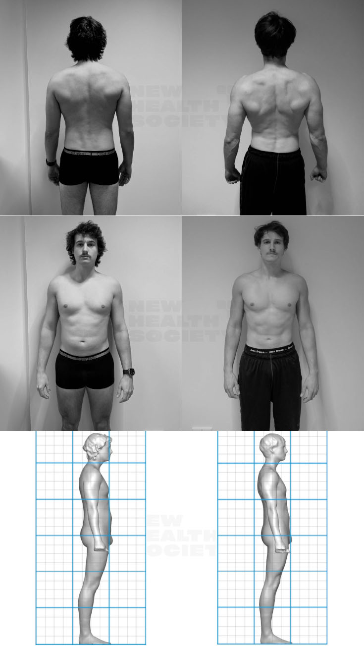 Livius transformation